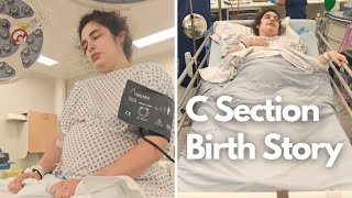 What they dont tell you about csection delivery in the uk [upl. by Adnat]