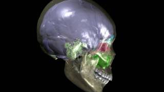 Human skull with brain endocast paranasal sinuses amp mastoid sinuses [upl. by Jaquiss]