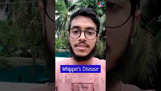 Whipples disease  Malabsorption syndrome  Pathology Medicine Surgery  Dr Med [upl. by Mirelle]