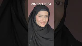 Concealer hack 2016 vs 2024 makeup shorts makeup youtubeshorts makeuptutorial [upl. by Benni]