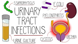 UTI Made Easy  Urinary Tract Infections Explained Clearly [upl. by Ednutey356]