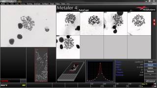 AutoCapt  Automated Image Acquisition with Metafer [upl. by Laughton211]