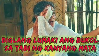 Malaking Bukol sa Kanyang Mata na Minsan Nakunan pa ng mga Uod [upl. by Cornew621]