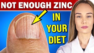 13 signs of zinc deficiency you should NOT ignore AND WHAT TO DO [upl. by Eilrebma]