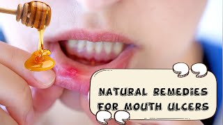 How To Relieve Mouth Ulcers Naturally And Effectively Natural Remedies For Mouth UlcersCanker Sore [upl. by Hake]