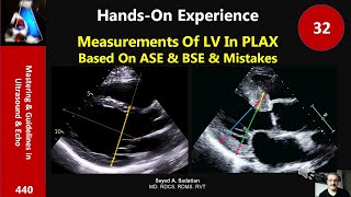 Measurements Of LV In PLAX Based On ASE amp BSE amp Mistakes Handson 32 [upl. by Ahsiral]