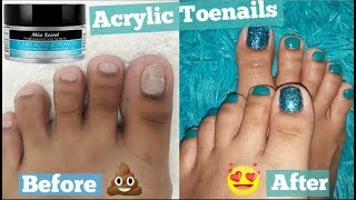 FOOT TRANSFORMATION How I extend my short Toenails using Acrylic without TIP   PEDICURE at Home [upl. by Edwards]