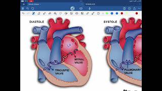 Valvular heart disease mitral stenosis [upl. by Enait]