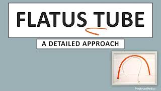 Flatus Tube detailed  SURGERY  Rapid Revision  USMLE [upl. by Shawn]