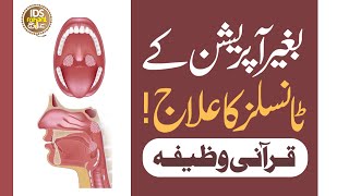 Baghair Operation Ke Tonsils Ka Ilaaj  Gale Ki Bimari Ka Ilaaj  Mufti Ghulam Dastageer [upl. by Dekeles]