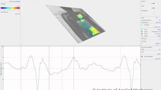 Vibration of abdomen with Scanning Laser Vibrometry [upl. by Pam]