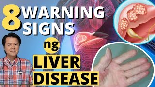 8 Signs You Have A FATTY LIVER [upl. by Nnaillek]