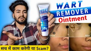 Wart Remover Cream Review  Wart Remover Ointment [upl. by Sille]