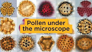 Pollen under the microscope [upl. by Kronick]