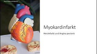 Herzinfarkt amp Angina pectoris einfach erklärt NSTEMI STEMI akutes Koronarsyndrom Risikofaktoren [upl. by Omle]