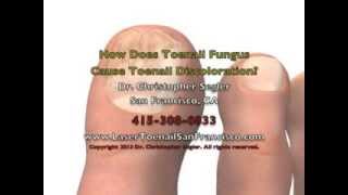 How Does Toenail Fungus Cause Toenail Discoloration [upl. by Euqcaj]