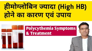 High hemoglobin Polycythemia Causes Symptoms Investigation and Treatment in Hindi [upl. by Ephram544]