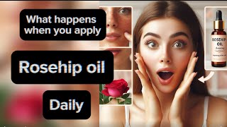 What happens when you apply rosehip oil on the face daily  let’s talk skincare [upl. by Yrannav]