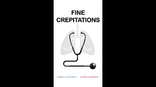 Fine Crepitations [upl. by Heywood]