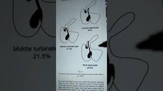 Variations in insertion of uncinate process [upl. by Geis]