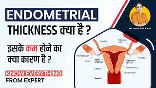 Endometrial thickness Cancer in Hindi Layers ThinEndometrial Hyperplasia Causes Treatment [upl. by Edrei]