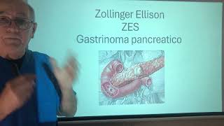 Síndrome de ZollingerEllison Gastrinoma Pancreatico Gastrinalike [upl. by Idelle]