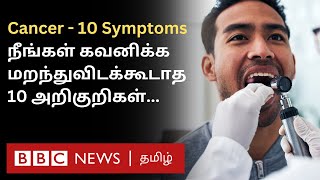 Cancer 10 Symptoms இதை சீக்கிரம் கவனிச்சிட்டா Treatment மூலம் குணப்படுத்திவிடலாம் [upl. by Eirene854]