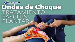 ONDAS DE CHOQUE  TRATAMIENTO FASCITIS PLANTAR con ESPOLON CALCANEO Fisioterapia  Fisiolution [upl. by Seabrooke]