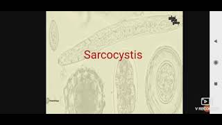 Sarcocystis para L3 [upl. by Lladnew]