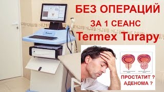 Лечение аденомы и простатита без операции в Самаре на Termex Turapy Термекс Турапи в клинике Наука [upl. by Eniawtna180]