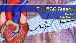 The ECG Course  Atrial Rhythms [upl. by Kassaraba199]