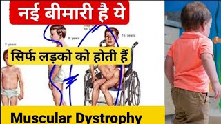 Bacchon ko is beemari se kainse bachayen  Muscular dystrophy ka ilaj aur uska symptoms [upl. by Smoht]