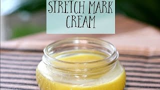 DIY lotion to get rid of stretch marks amp prevent stretch marks Best Homemade Cream For Stretch Marks [upl. by Asenev]