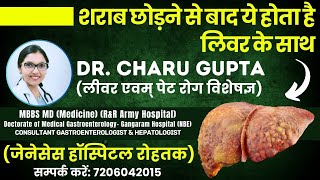 शराब छोड़ने के बाद लिवर का क्या होता है Alcoholic liver disease  Hindi  Dr Charu Gupta  Liver [upl. by Aynos]