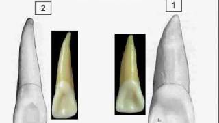 Dentition Identification121part1of3m4v [upl. by Enaz]