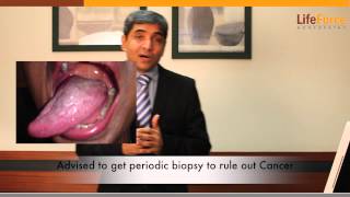 Treatment for Oral Lichen Planus Explained by Dr Rajesh Shah MD [upl. by Notsreik]