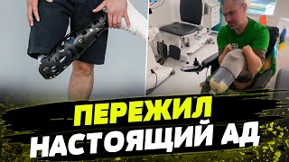 Кадыровцы АМПУТИРОВАЛИ ВСЕ ЧЕТЫРЕ конечности В это СЛОЖНО ПОВЕРИТЬ история украинского защитника [upl. by Giacamo]