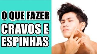 🔴 O QUE FAZER COM AS ESPINHAS E CRAVOS feat EI ANDREW  PELE MASCULINA [upl. by Grannias]