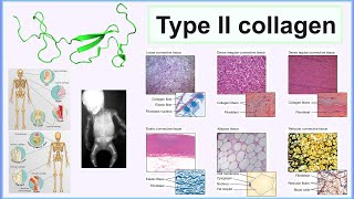 type II collagen [upl. by Hardner]