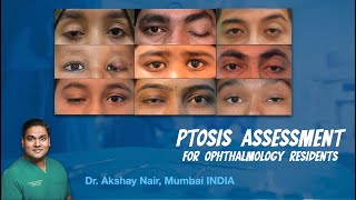 Ptosis Evaluation for Ophthalmology students  Residents and Fellows [upl. by Maupin]