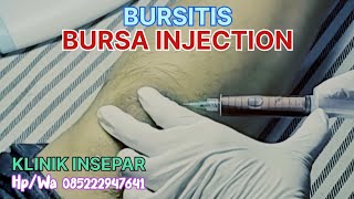 BURSITIS  BURSA INJECTION  ruralhealthcare syarhan [upl. by Anayi17]