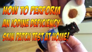 Perform an iodine deficiency skin patch test at home [upl. by Airotkciv863]