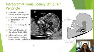 Beyond the ‘Nuchal’ Getting the Most from the 1114 Week Ultrasound  Michelle Sutherland  AFIC [upl. by Aisiat]