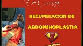 Recuperación de Abdominoplastia  Dr Cortes [upl. by Yanarp]