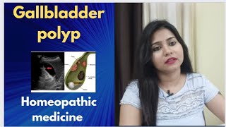 Gallbladder polyp homeopathic medicine  Gallbladder polyp symptomscauses amp homeopathic treatment [upl. by Ema]