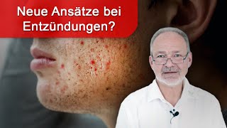 Entzündungen natürlich behandeln  neue Studien und Therapieansätze [upl. by Berte609]