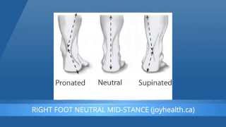 Foot Pronation And Supination  What Is The Difference [upl. by Lassiter196]