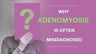 Adenomyosis Symptoms Why Adenomyosis Is Often Misdiagnosed And What to Do About It [upl. by Irisa]