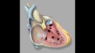 What Is a Ventricular Septal Defect VSD [upl. by Ireg56]