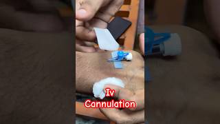 Iv cannulation  cannula doctor baby ivcannulation SMpharmacy subscribe [upl. by Eirased]